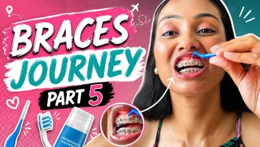 Braces Journey Part 5 | How I Clean My Braces Daily 🦷✨