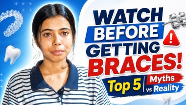 WATCH BEFORE GETTING BRACES! 😱 | Top 5 Braces Myths vs Reality You Must Know #braces #bracesjourney