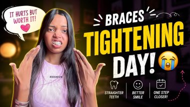Before You Get Your Braces Tightened🦷… WATCH THIS! ⚠️🤯