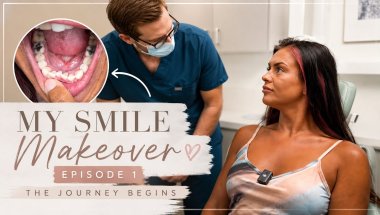 My Smile Makeover Begins! 😬 Invisalign, Composite Bonding & My Biggest Insecurity