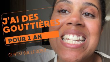 Je démarre mon traitement d’orthodontie !!! (j’aligne mes dents quoi)