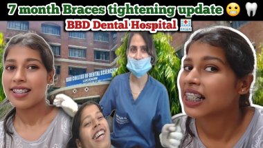 7 month braces tightening update🦷😬| BBD Dental hospital🏥 #bracestightening #lucknow #dentalbraces