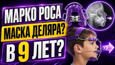 Аппарат Марко Роса и маска Деляра в 9 лет: когда это действительно нужно?