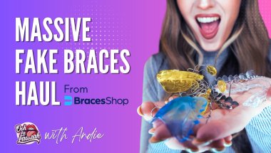 Unboxing a Massive Haul of Orthodontic Devices & Fake Braces