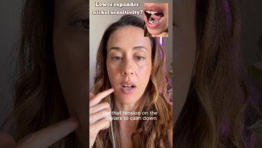 My thoughts on lower expander two weeks after installation