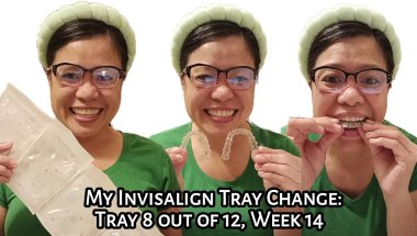 My Invisalign Tray Change: Tray 8 out of 12 Week 14 | Experience | Tagalog