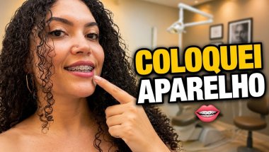 O DIA QUE COLOQUEI APARELHO ORTODÔNTICO 😬 | Diário de Uma Ortognática🦷 #eps4