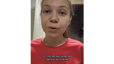 восстанавливаюсь после ортогнатии в инст @anna_kuz94