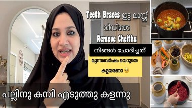 Finally Teeth Braces Remove Cheithu .. ഇത്രയും നല്ല Result കിട്ടും എന്ന് വിചാരിച്ചില്ല