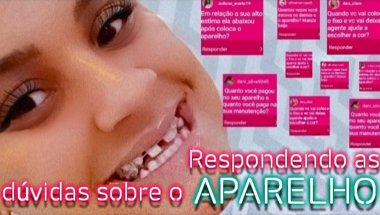 Respondendo as dúvidas sobre o aparelho fixo e aparelho movel | Isabele Alves