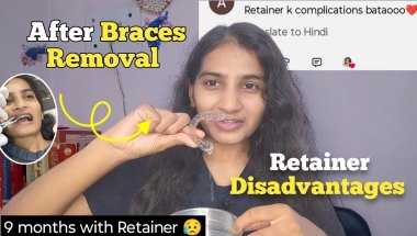 Retainer Problem Explained! | 9 months with retainer | experience after Braces Off 😨