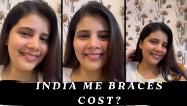 Braces cost in india 2026:full price breakdown +Hidden charges exposed #viral #youtube #trending