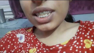 My braces journey exercise experience!?🙆‍♀️ my thoughts🤔💭on braces #braces #transformation #youtube