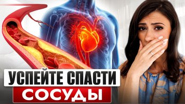 Если вам за 40, то ваши сосуды молча разрушаются | Как остановить скрытый атеросклероз