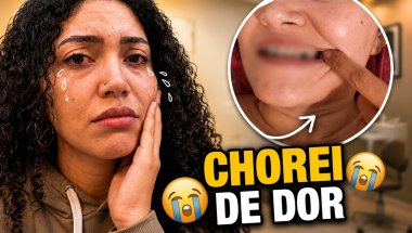 TIVE QUE ARRANCAR MEUS DENTES 😵‍💫  | Diário de uma Ortognática 🦷 #eps5