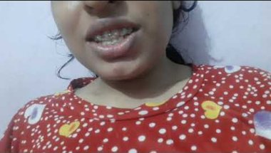 Braces tidening ke baad difficulties?! Ups and downs days with braces😖 #transformation #braces#like