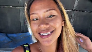 Filipina Twin Sister Janice Finally Gets Her Braces Done! MOUNTAIN LIVING PHILIPPINES