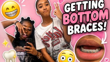 Bottom Braces Vlog! 🩷 My Honest Reaction | Cutie Ways