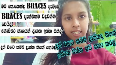 Braces දාන්න ආසාවෙන් ඉන්න ඔයාටත් ඔන්න මගෙන් පුංචි උදවුවක් 🦷👀😁