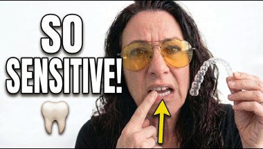 Tray 14 of 41 - Nobody Warned Me About This! (Tooth Sensitivity)