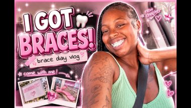 💕 I finally got braces... AGAIN🦷💖✨