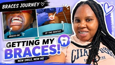 Braces Day//My smile journey continues...Vlog
