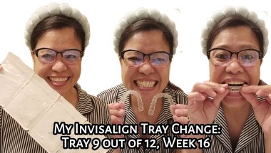 My Invisalign Tray Change: Tray 9 out of 12 Week 16 | Experience | Tagalog