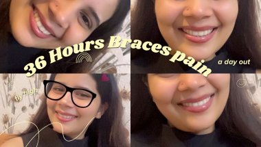 36Hours Braces pain🥹🥲#youtube #trending #viralvideo #brace s#pain