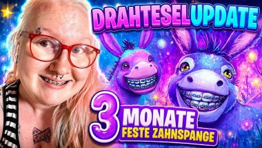 Drahteselupdate 💜 | 3 Monate feste Zahnspange #update #bracesjourney