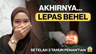 AKHIRNYA LEPAS BEHEL!😱 Hasil Akhirnya Bikin Senyum Makin Pede