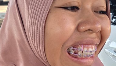 Kontrol behel dibulan ke empat