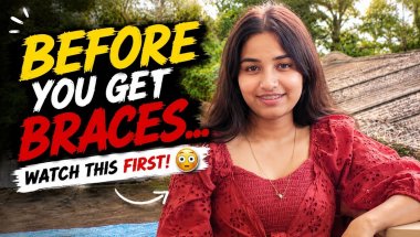 Before You Get Braces..Watch This First! 😳 | My Honest Braces Experience#bracesjourney #braces #yt