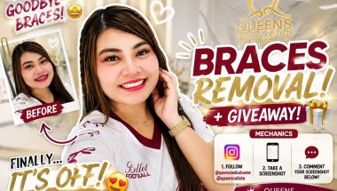 GOODBYE BRACES + GIVE AWAY SA BLUE APP