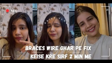 Braces wire ghar pe fix keise kre sirf 2 min me⚠️#viral #youtube #braces #trending #teeth #trendingv