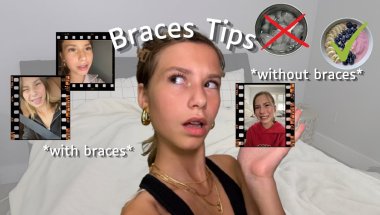 Braces Tips!🎀✨