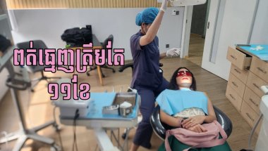 ដំណើរពត់ធ្មេញពីដើមដល់ចប់