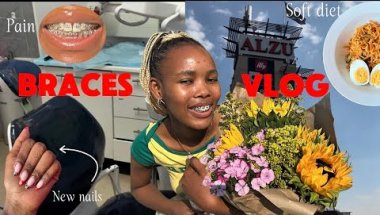 I GOT MY BRACES !! | Braces reveal | My experience | diet changes | pain scale (very painful)