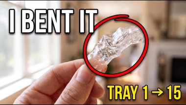 Tray 15 of 41: I BENT My Invisalign & My Teeth Moved This Much (Tray 1 vs 15)