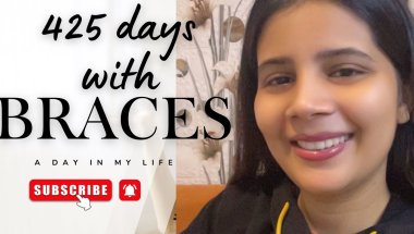 425 days with braces 🥹Worth it ? My full transformation #viral #trending #braces #trendingvideo #