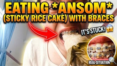 Eating *ansom* (sticky rice cake) with braces. #teeth #eat