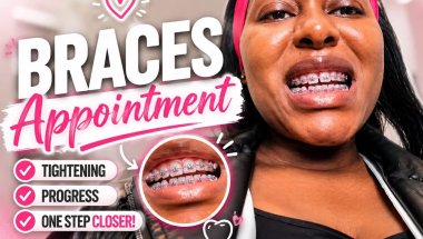 Braces Appointment