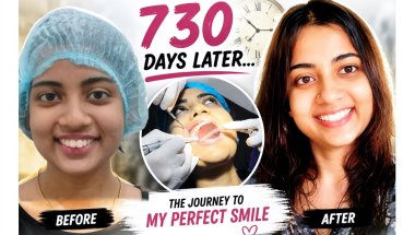 Braces Removal After 2 Years | My Smile Transformation (Painful?)| Orthodontist Q&A | Adult braces😭