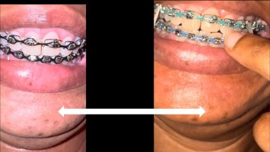GOT NEW COLOR PLUS TEETH UPDATE
