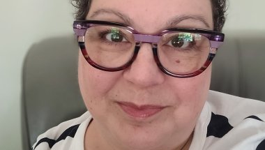 Braces ( Day 14 )
