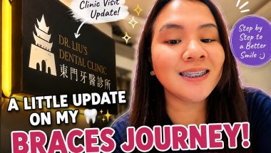 A Little Update on My Braces Journey | Progress After a Few Months 🦷✨