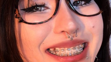 Can My BRACES Survive This Junk Food Mukbang?! 😱  ASMR