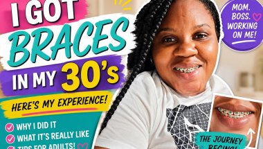 Braces in my 30's/My Honest Experience