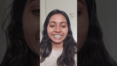 PART 1 of my 6 Months Braces Update | Watch this Before Getting Braces🦷| problem হলে কি করা উচিৎ 🪥🦷