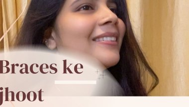 Kya Braces lagwane ke baad teeth weak ho jate hai#viral #trending #youtube #shorts #viralvideo