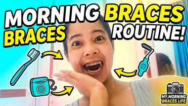 Morning activities #teeth #braces